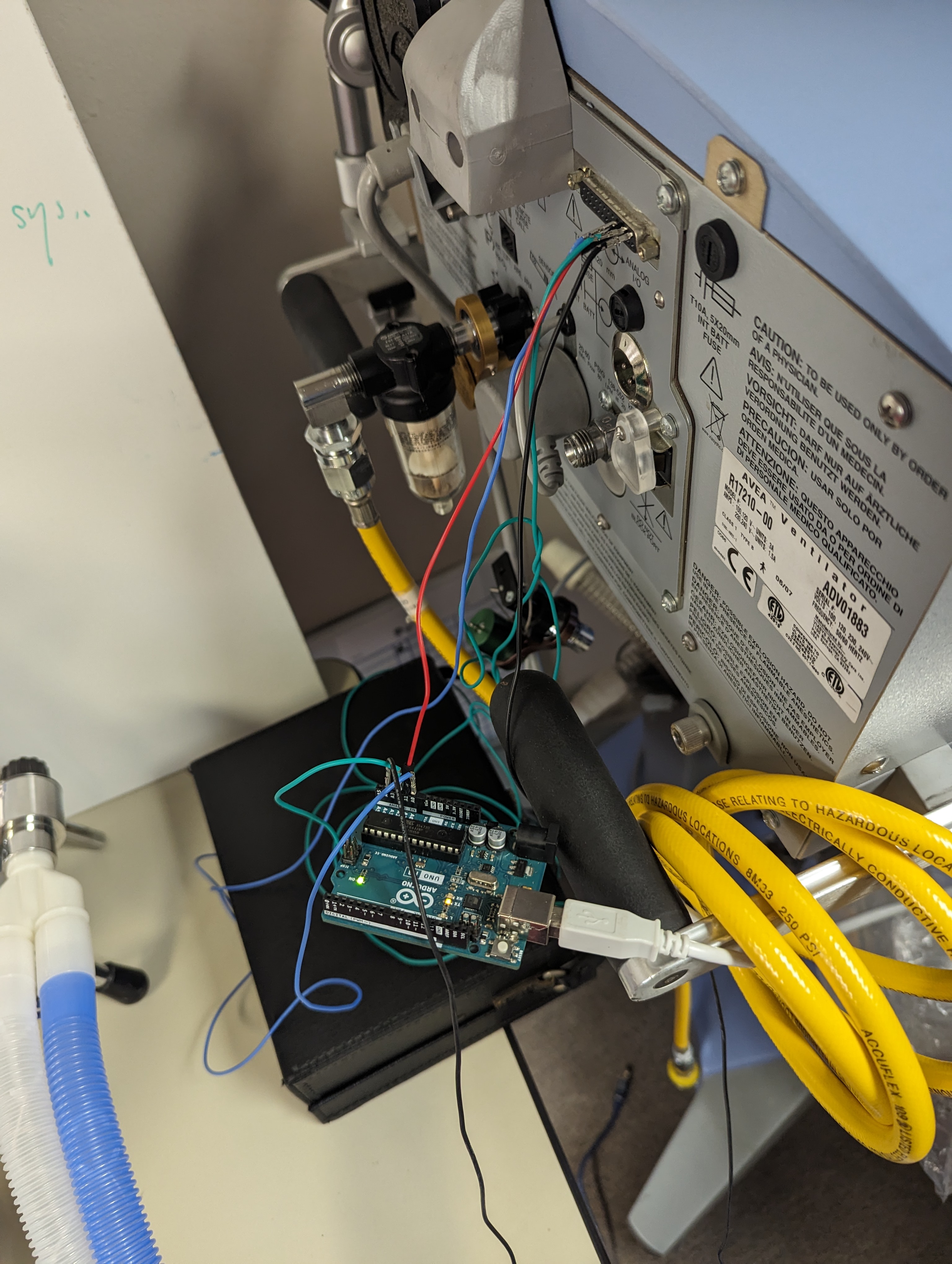 Ventilator to Arduino connection setup